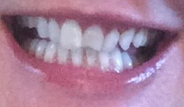 Starting over after 25 years - Part deux