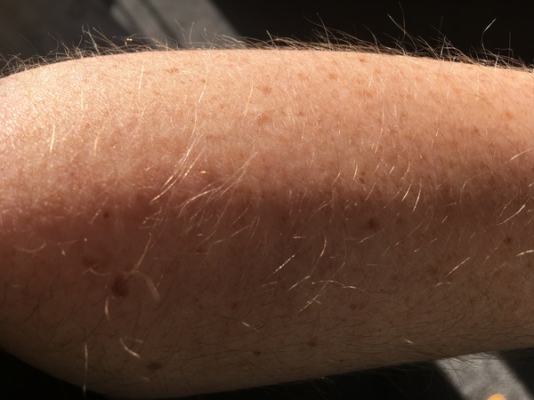 Hairy arms