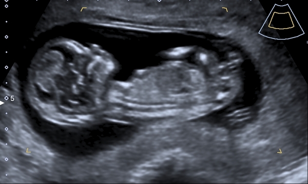 Gender guesses