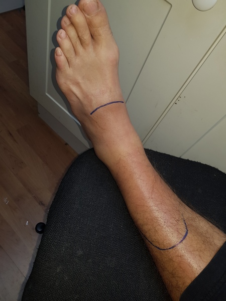 Help me get DH to the doctor's