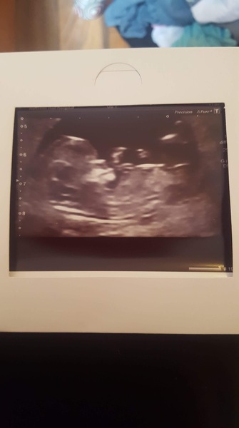 Any guesses of the sex?