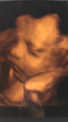 December 2018 Babies - Thread #4