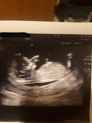 Nub or leg? Boy or girl? Please lend me your eyes!