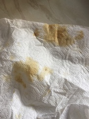 What is leaking from my car?