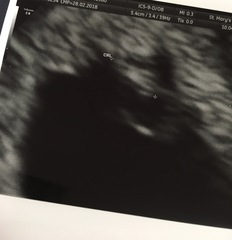 6 week scan