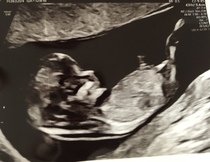 Gender prediction?