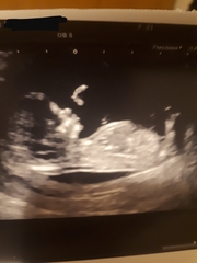 Nub or leg? Boy or girl? Please lend me your eyes!