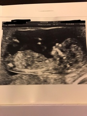 Can anyone guess the gender?! Nub? 12+6
