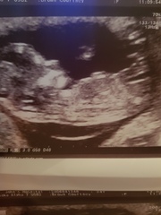 Gender guesses please
