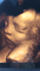 December 2018 Babies - Thread #4