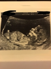 Can anyone guess the gender?! Nub? 12+6