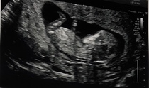Any gender guesses? 12 week scan :)