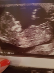Gender guesses please