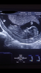 April 2019 babies continued