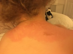 Itching!