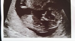 Awkward baby position - gender guesses!
