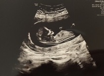Gender prediction?