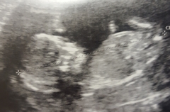 The March-ers 2019 #6