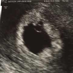 6 week scan