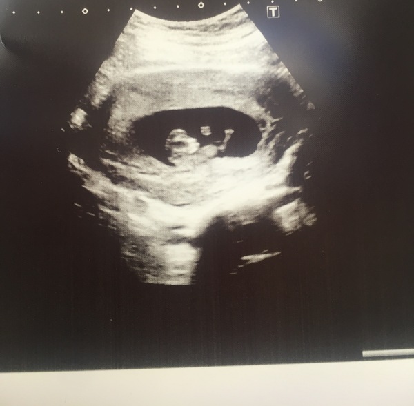 June 2019 - Thread 2