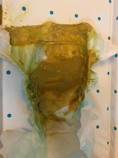 Teething or something else? (TMI poo pic attached)