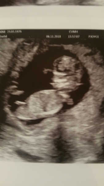 New babies sex
