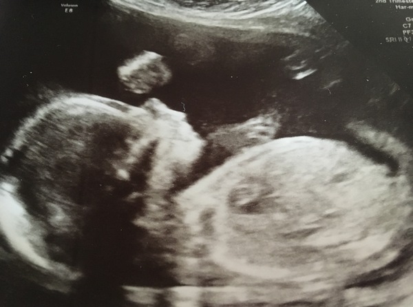 The March-ers 2019 #6