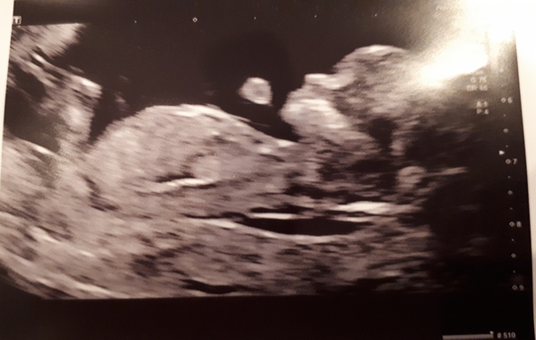 Just got Very first BFP!! Due May 2019 anyone else??