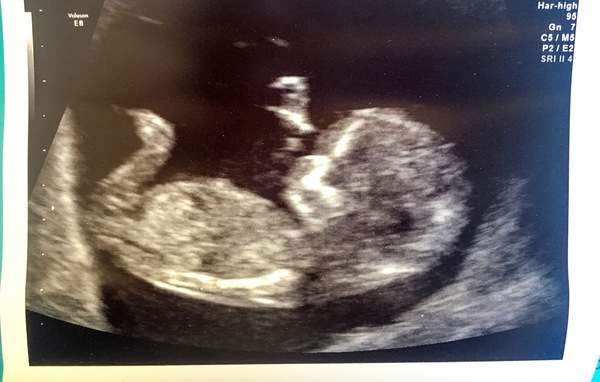 June 2019 - thread 3