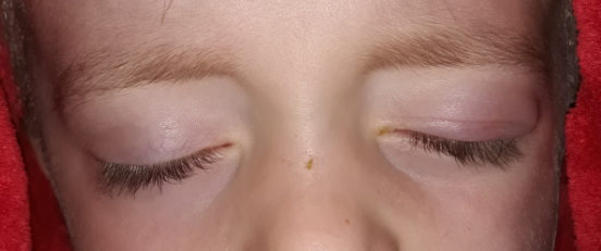 URGENT eye advice needed