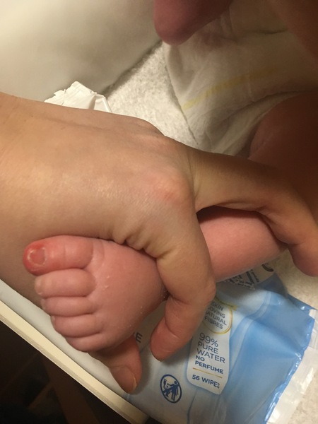 Red toe on 5 week old