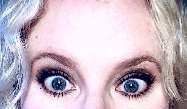 I had botox today!