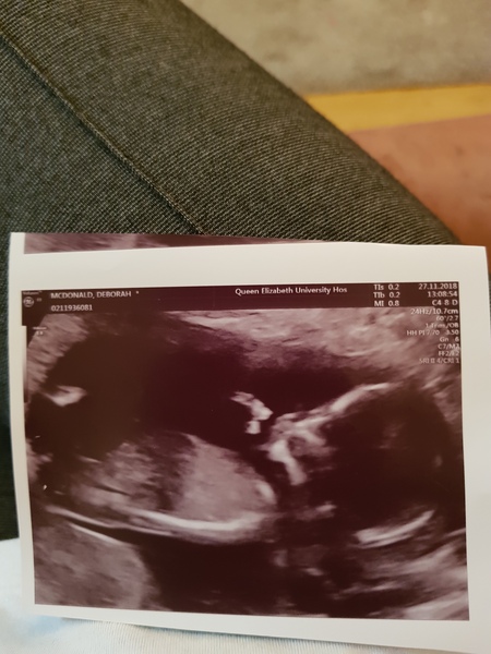 13 weeks boy or girl guesses?
