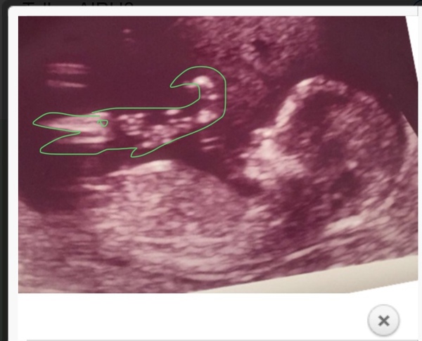New babies sex