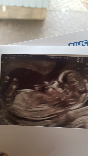 First baby due June 2019!