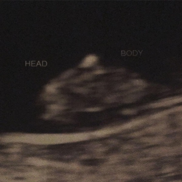 MMC - just got scan photos