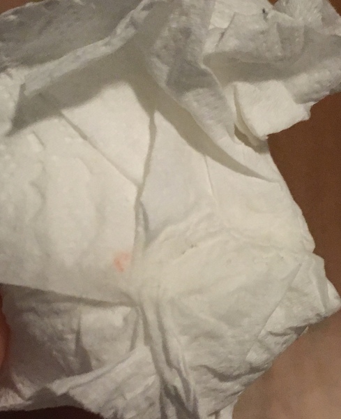 Implantation bleeding or late ovulation?