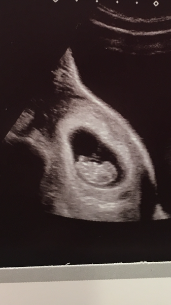 June 2019 - thread 3