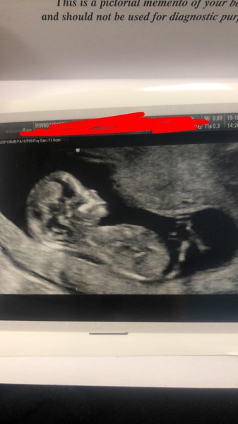 Gender guesses anyone?