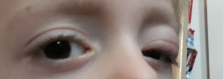 URGENT eye advice needed
