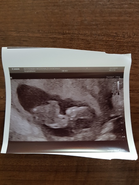 gender guesses please??