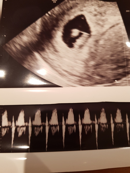 June 2019 - thread 3