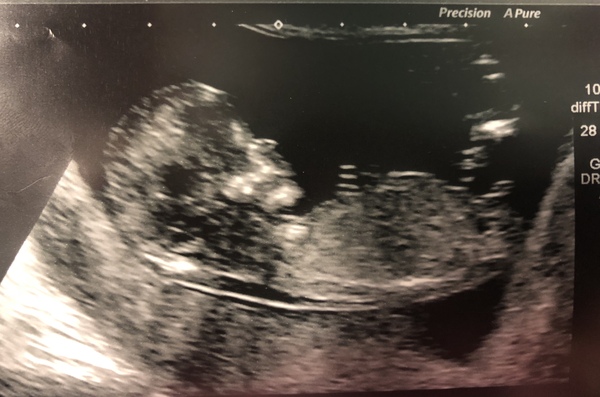 Just got Very first BFP!! Due May 2019 anyone else??