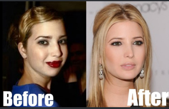 Can anyone become beautiful?