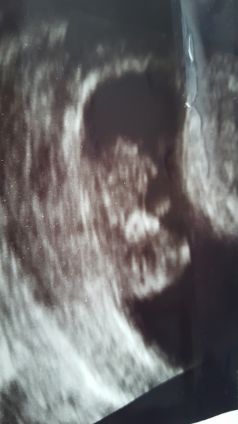 June 2019 - thread 3