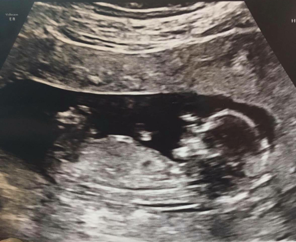 Is this a boy or girl?