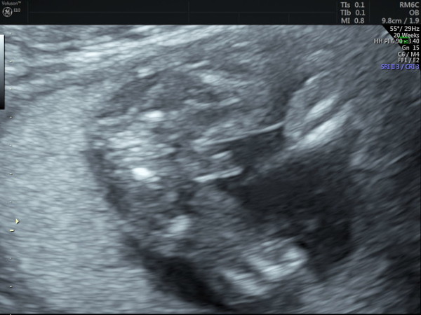 16+6w gender scan- do you agree?