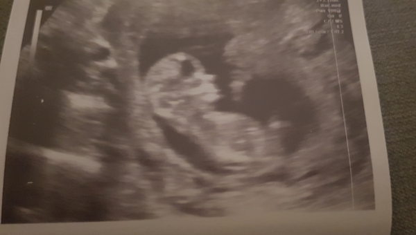 Dating scan next week - anyone else?