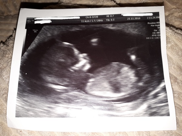 June 2019 Thread 4 - sliding towards 2nd trimester