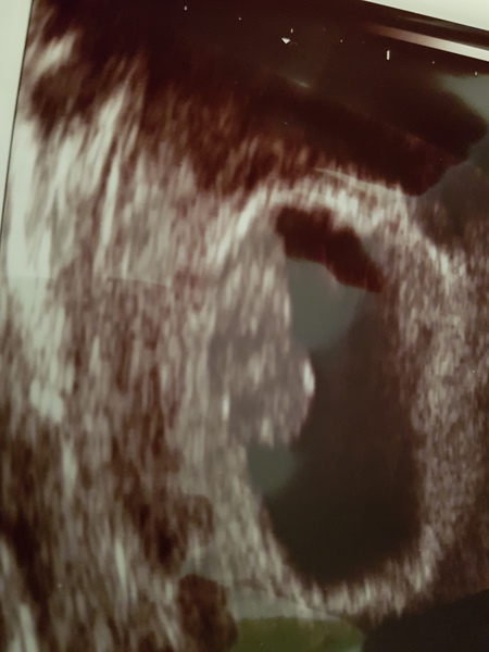 June 2019 - thread 3